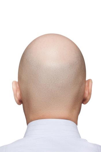 Bald head