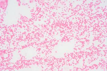 Bone marrow biopsy from myelodysplastic condition | Image credit: tonaquatic - stock.adobe.com