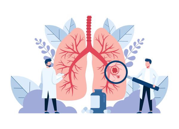 Cartoon doctors examining lungs | Image credit: males_design - stock.adobe.com