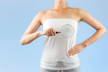Image of a woman with breast cancer