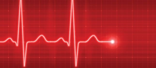 Heart Attack Survivors Have Reduced Risk of PD, Secondary Parkinsonism