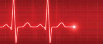 Cardiac graphic