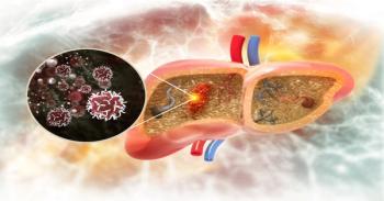 Liver cancer | Image Credit: Crystal light - stock.adobe.com