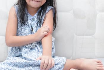 Girl scratching itch | Image credit: kwanchaichaiudom - stock.adobe.com