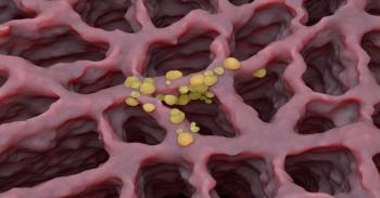 image of lung cancer | Image Credit: laszlo-stock.adobe.com