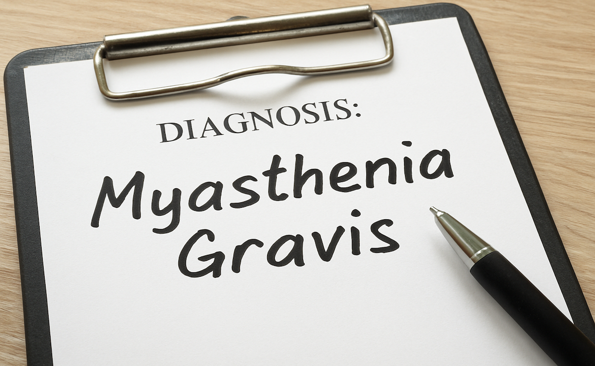 myasthenia gravis | Image Credit: © Maggie-sora.chatgpt.com