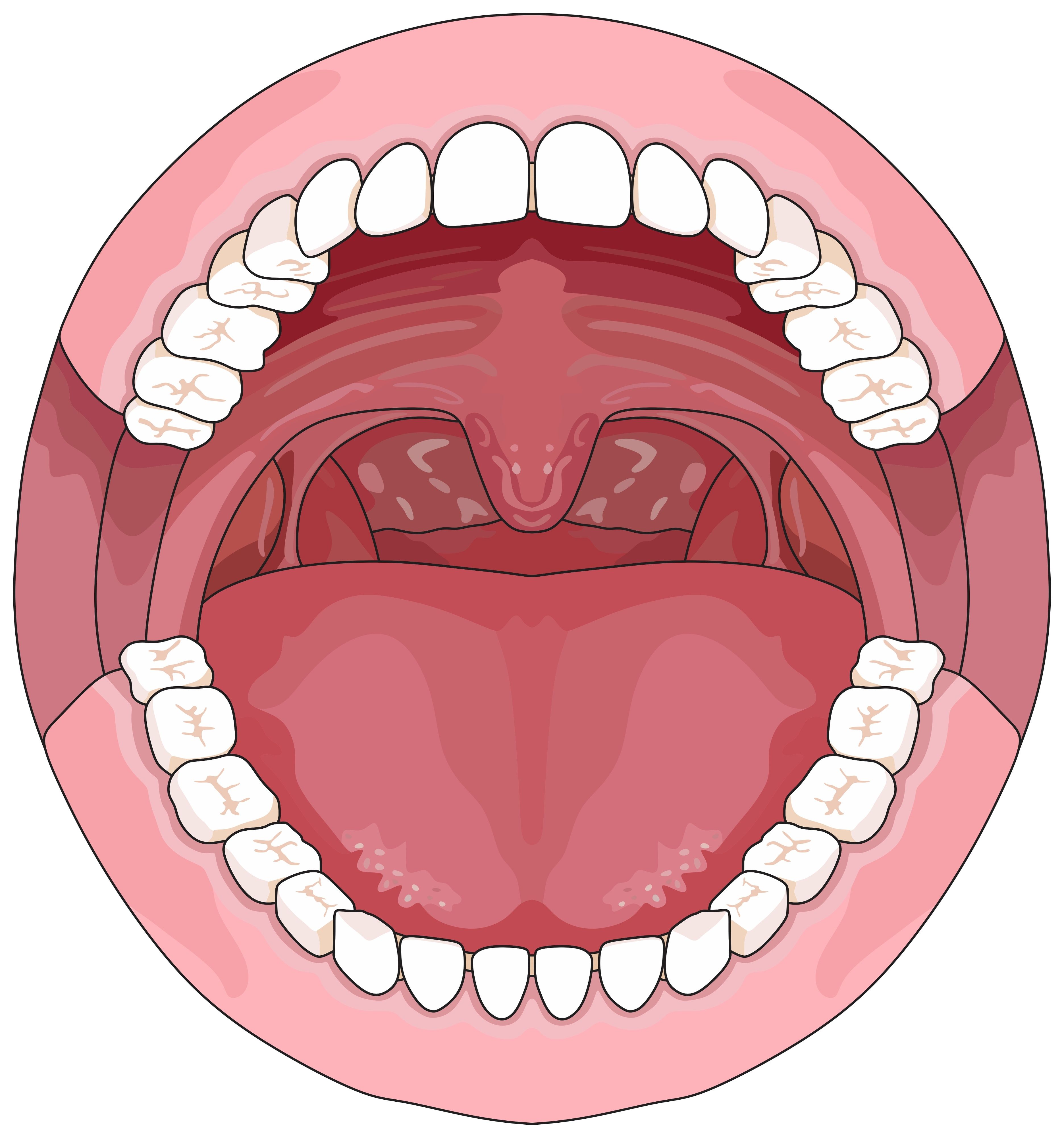 Children With SCD Exhibit Distinctive Palatal Rugae Patterns