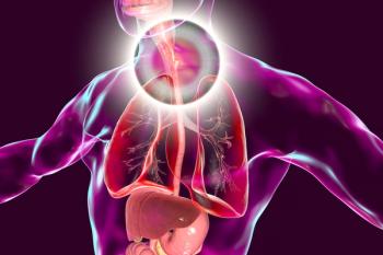 Esophageal cancer illustration | Image credit: Dr_Microbe - stockadobe.com