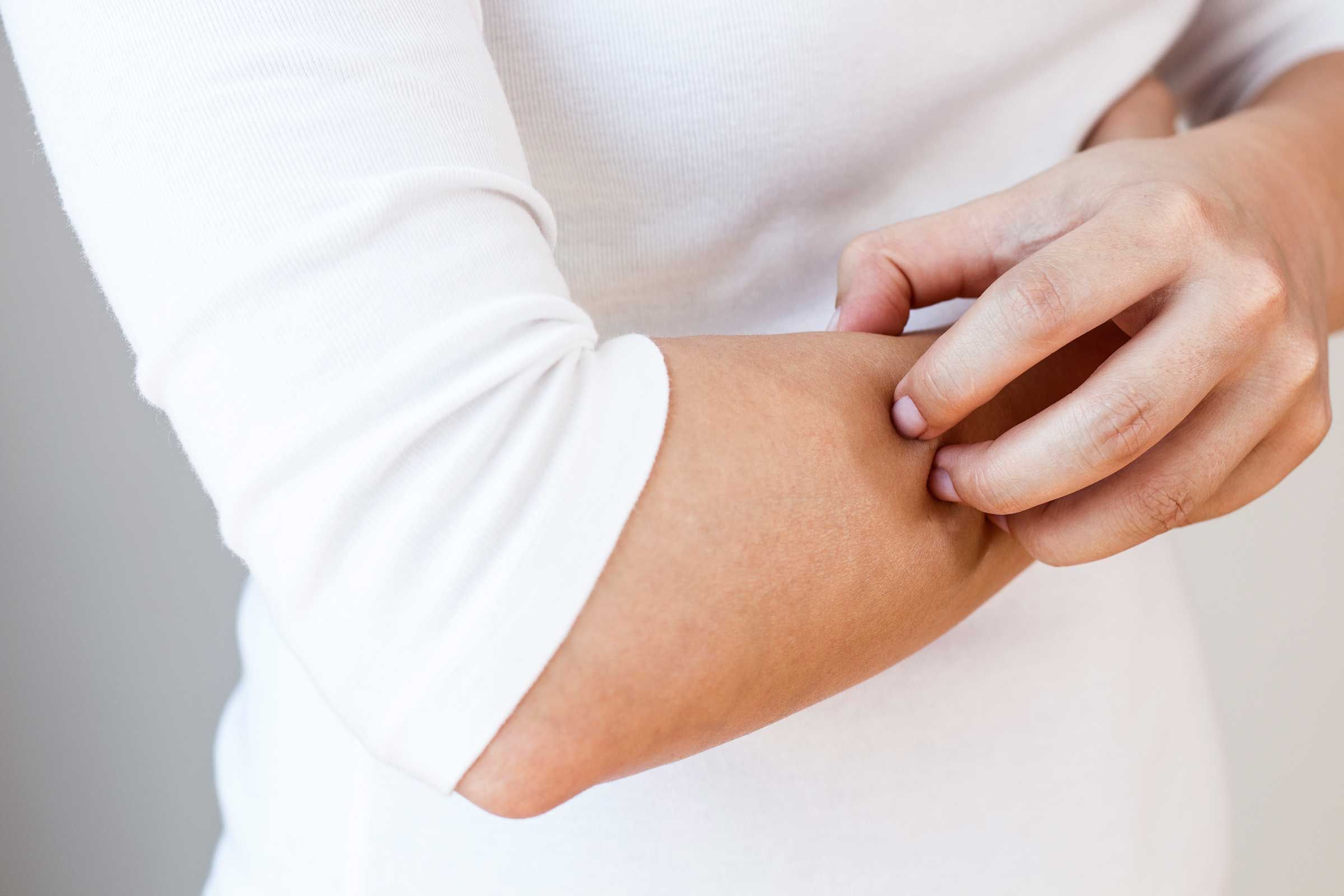 woman scratching her arm