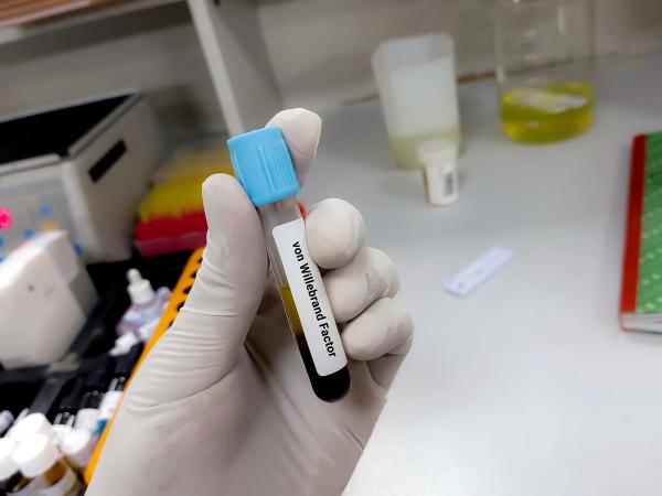 Scientist hold blood sample for von Willebrand factor test. Healthcare and medical test concept. | Image credit: Innovative Creation - stock.adobe.com