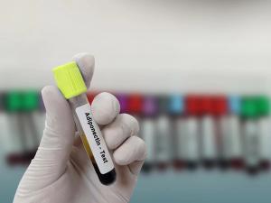 Patients with elevated levels of multiple adipokines had the highest risk, the authors found. Image credit: Innovative Creation - stock.adobe.com