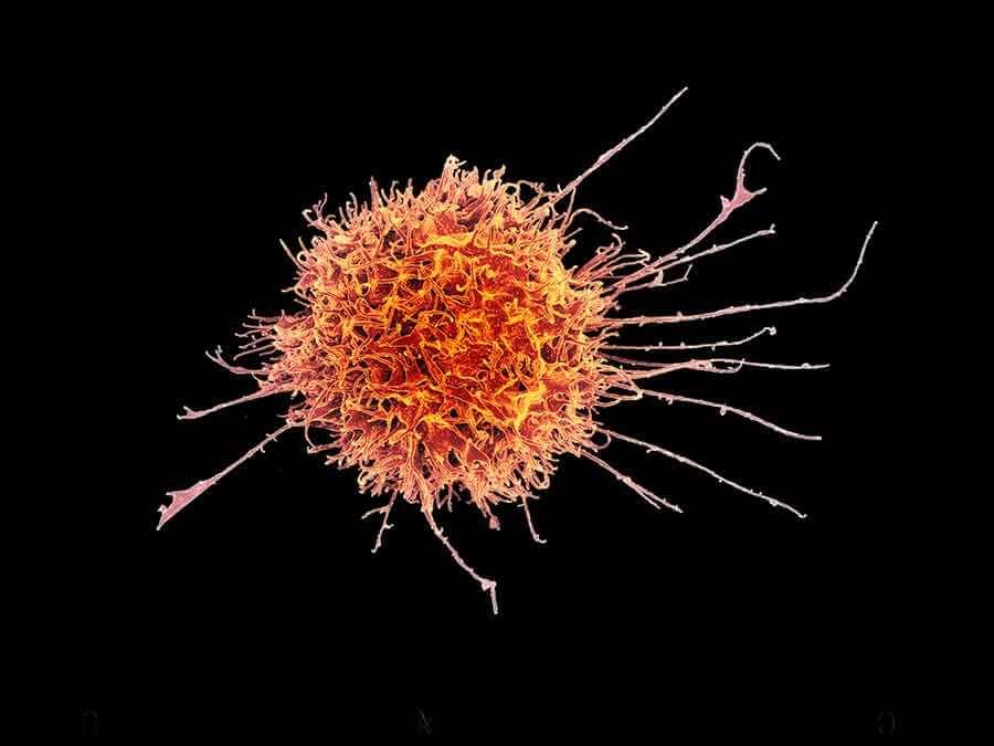 Natural killer cell