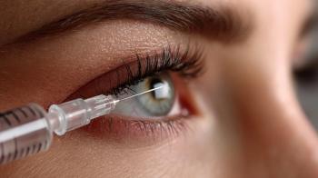 Intravitreal Injection Close-Up of Eye Receiving Treatment for Macular Degeneration and Retinal Diseases| Image Credit: © Maris Maskalans - stock.adobe.com
