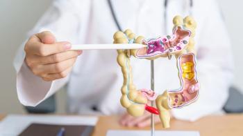 Doctor with human Colon anatomy model. Colonic disease, Large Intestine, Colorectal cancer, Ulcerative colitis, Diverticulitis, Irritable bowel syndrome, Digestive system and Health concept | Image credit: © Jo Panuwat D - © Jo Panuwat D - stock.adobe.com