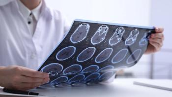 Doctor examining MRI images of patient with multiple sclerosis at table in clinic, closeup | Image credit: © New Africa - © New Africa - stock.adobe.com