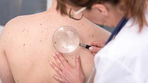 Dermatologist examining the skin of a patient | Image credit: © thodonal - © thodonal - stock.adobe.com