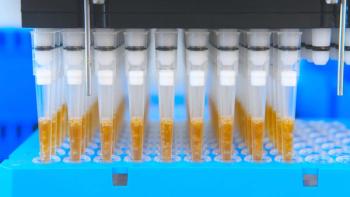 eplisterra/Stock.Adobe.com – automation helps ease the burden of multiple sample preparations for analytical testing