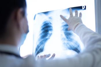 A healthcare provider wearing gloves examines a chest X-ray displayed on a lightbox. | Image Credit: © as-artmedia - stock.adobe.com