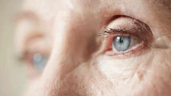 Close up of eyes for a patient with retinal disease. | Image Credit: © pressmaster - stock.adobe.com