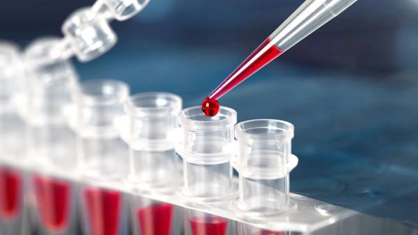 Why Automation with the Correct Liquid Handler is Integral to Improved NGS Outcomes