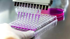 Researcher using micropipette dropping solution to microplate, for biologic tests. 96 well plate with samples for biological analysis. Scientist hand holding microplate for biomedical research. Clos | Image credit: © Serap - © Serap - stock.adobe.com