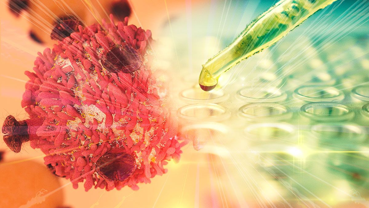 Gene Therapy for Cancer Treatment Concept Cancer therapy with T-cell and pipette | Image Credit: © catalin - © catalin - stock.adobe.com