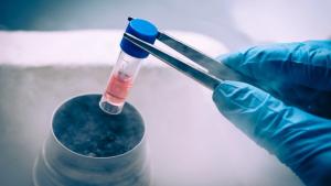 Reducing Risk: Establishing Consistency and Scalability of Cell Therapy Starting Material