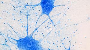 Education Spinal cord and Motor Neuron under the microscope in Lab. | Image credit: © sinhyu - © sinhyu - stock.adobe.com