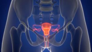 3D illustration of a translucent human pelvis with the uterus, fallopian tubes, ovaries, cervix, and vagina highlighted in orange against a blue background. | Image Credit: © magicmine - stock.adobe.com