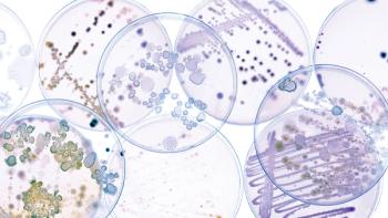 Growing Bacteria in Petri Dishes on agar gel Scientific experiment. | Image Credit: ©luchschenF- Stock.Adobe.com