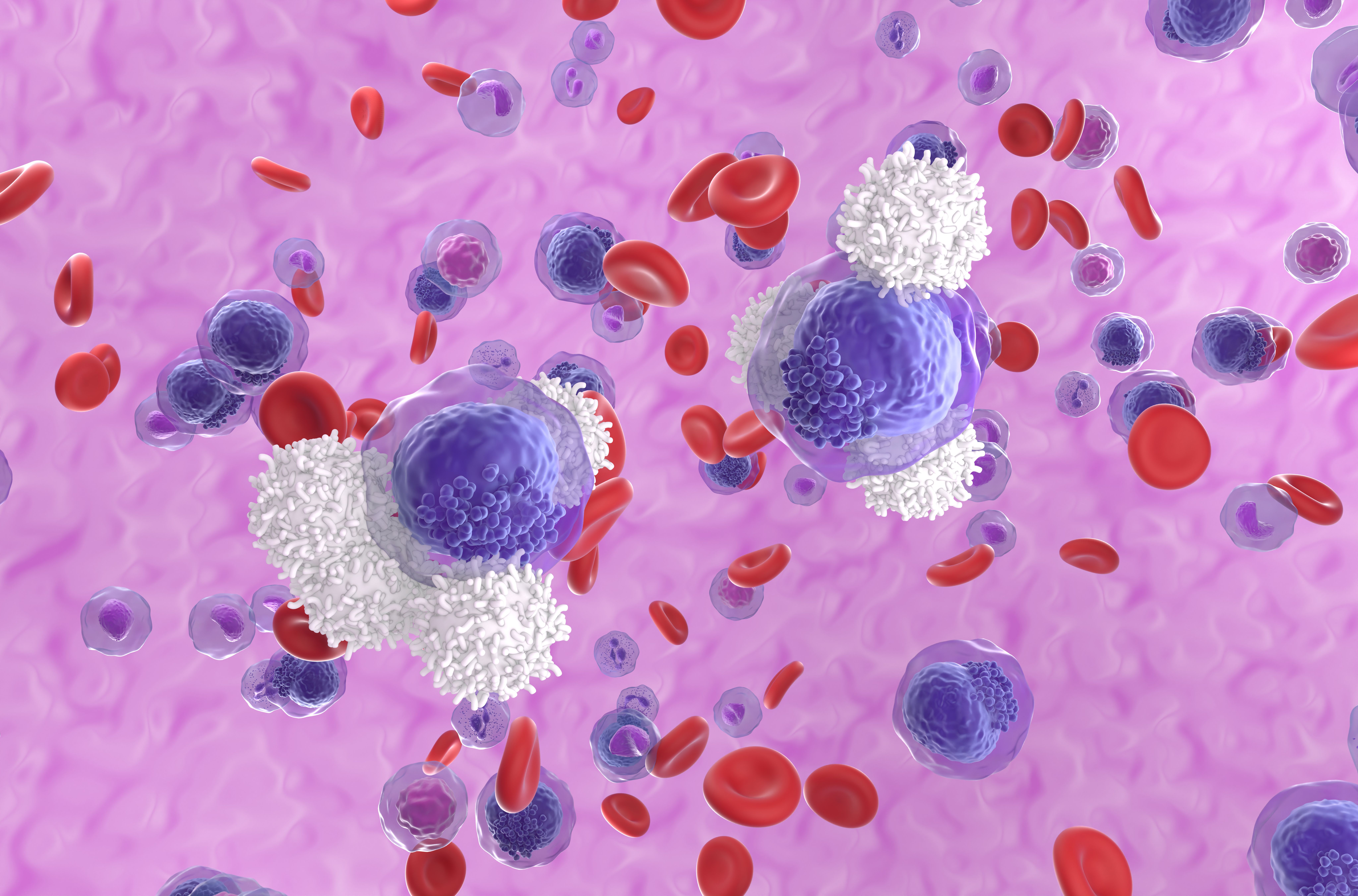 T-cells attack acute myeloid leukemia (AML) cells in blood flow - isometric view 3d illustration. | Image Credit: © LASZLO - stock.adobe.com