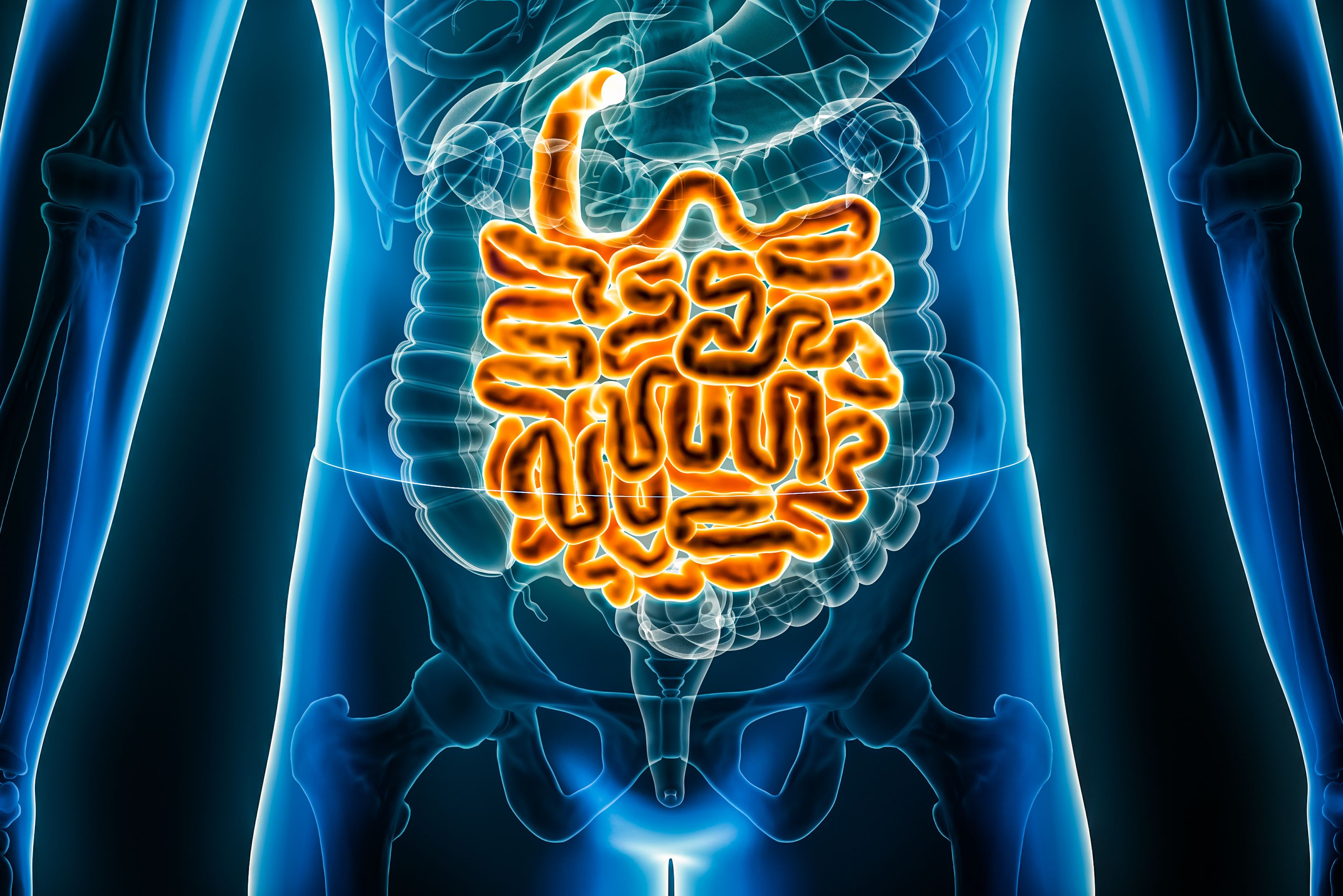 FDA Approves On-Body Injector Induction for Skyrizi in Crohn's Disease