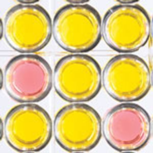 Catalytic Site Analysis and Characterization of a Solvent-Tolerant Aldo-Keto Reductase
