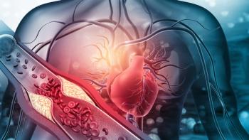 Human heart with blocked arteries. 3d illustration. | Image credit: © Rasi - © Rasi - stock.adobe.com