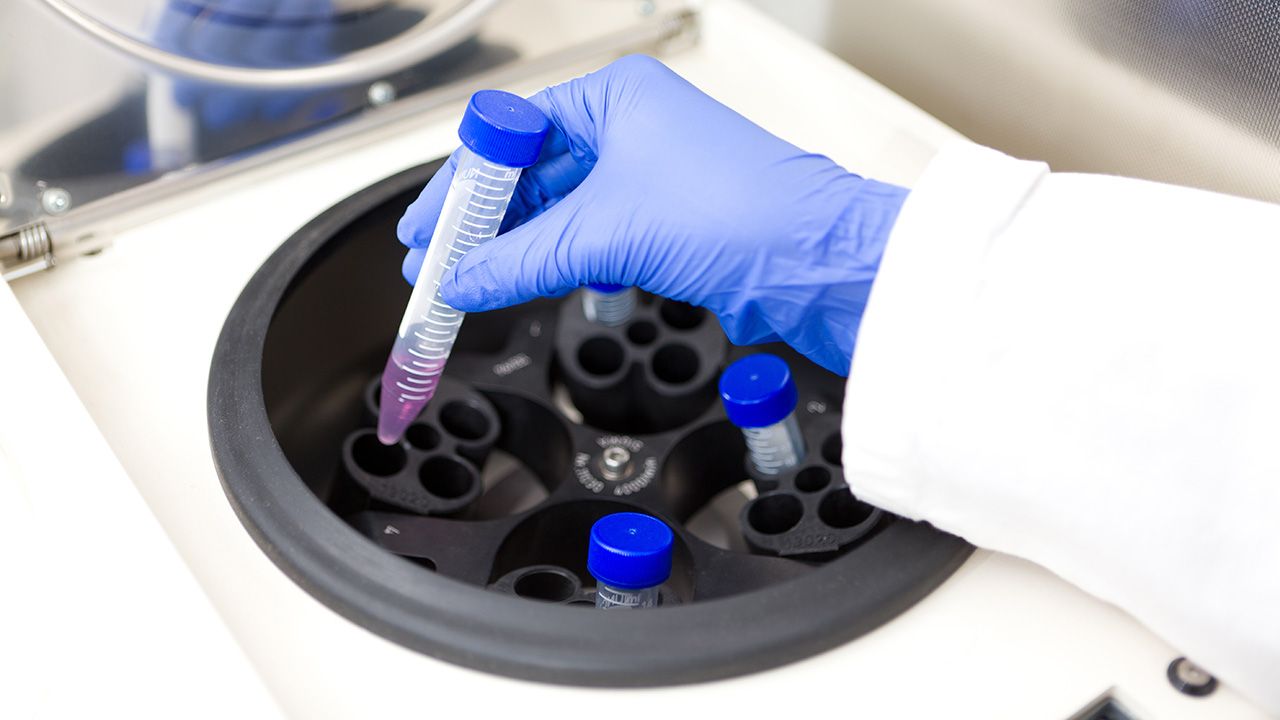Scientist putting test tube into centrifuge | Image credit: © Vit Kovalcik - © Vit Kovalcik - stock.adobe.com
