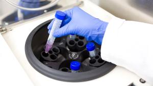 Scientist putting test tube into centrifuge | Image credit: © Vit Kovalcik - © Vit Kovalcik - stock.adobe.com