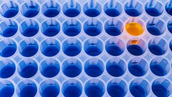 Detecting Residual HCPs Demands a Holistic Approach; image: eplisterra - Stock.adobe.com