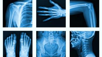 Collage of many X-rays in very good quality. | Image credit: © itsmejust - © itsmejust - stock.adobe.com