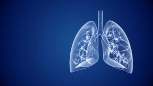 3D illustration of translucent white human lungs with the trachea and branching airways against a dark blue background, positioned on the right side of the frame. | Image Credit: © Silver Place - stock.adobe.com
