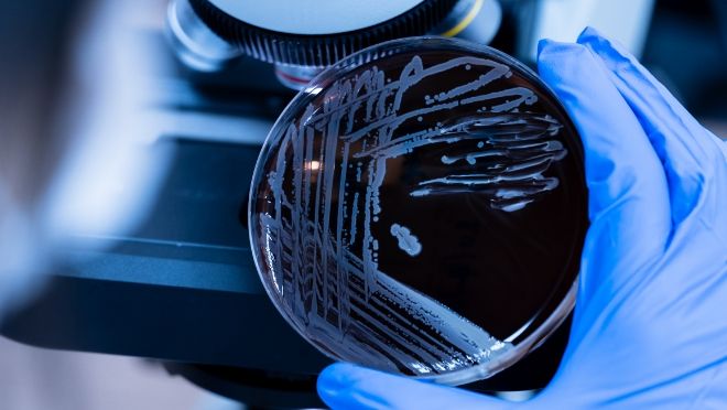 Accelerating and Streamlining Microbial Process Development With a Novel Technology