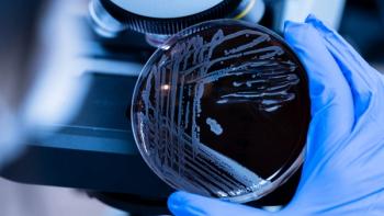 Accelerating and Streamlining Microbial Process Development With a Novel Technology