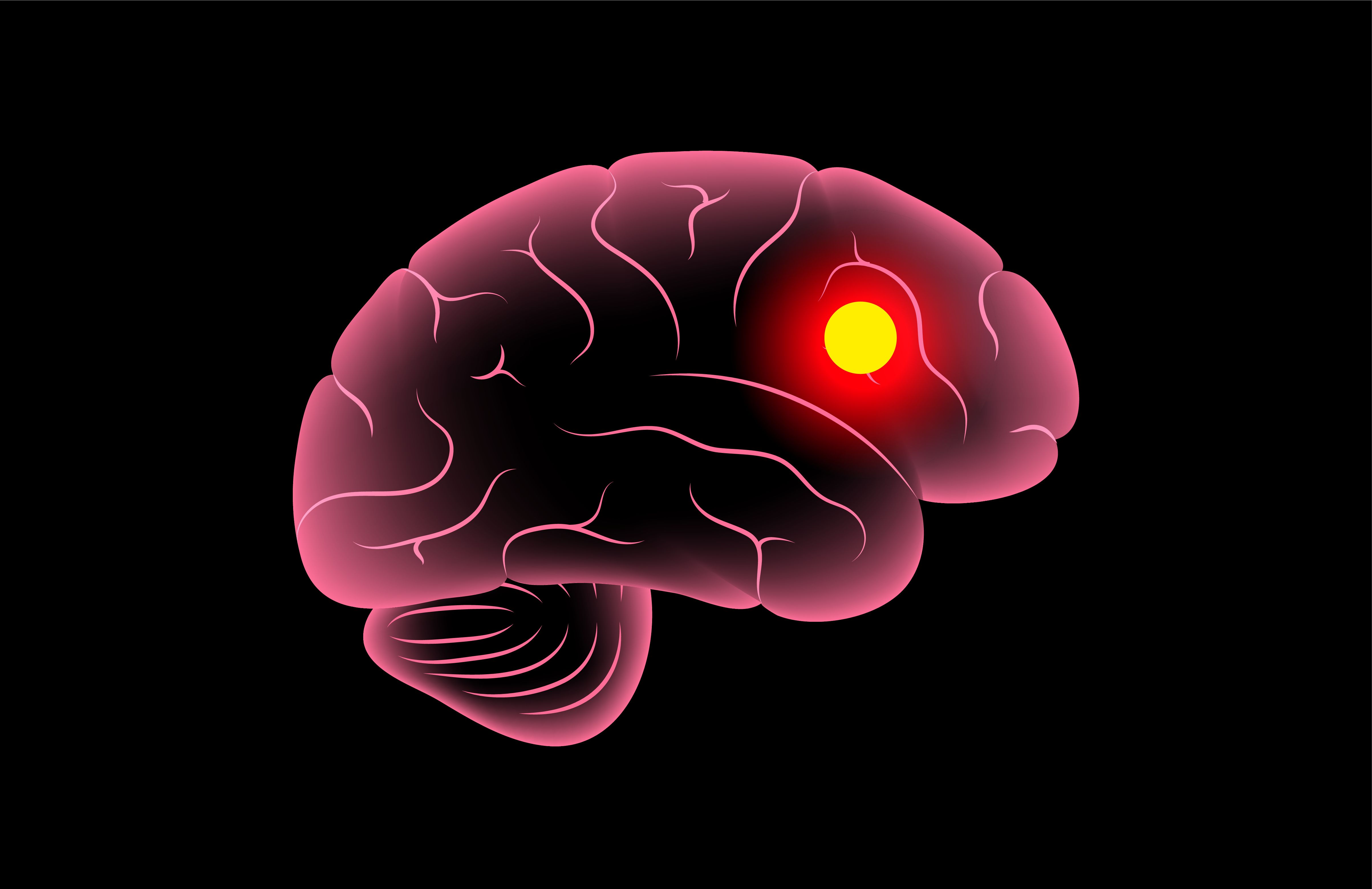 Brain cancer poster | Image Credit: © pikovit - stock.adobe.com