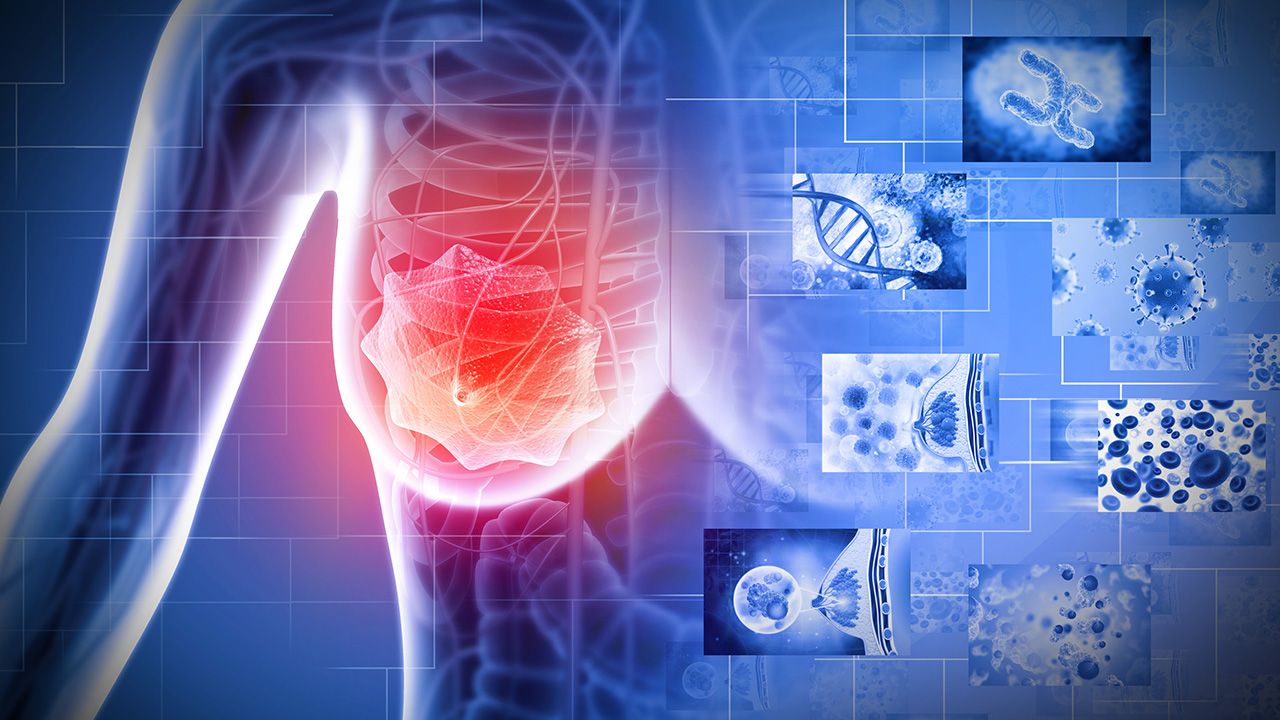 Breast cancer. Female breast anatomy. 3d illustration | Image credit: © Crystal light - © Crystal light - stock.adobe.com
