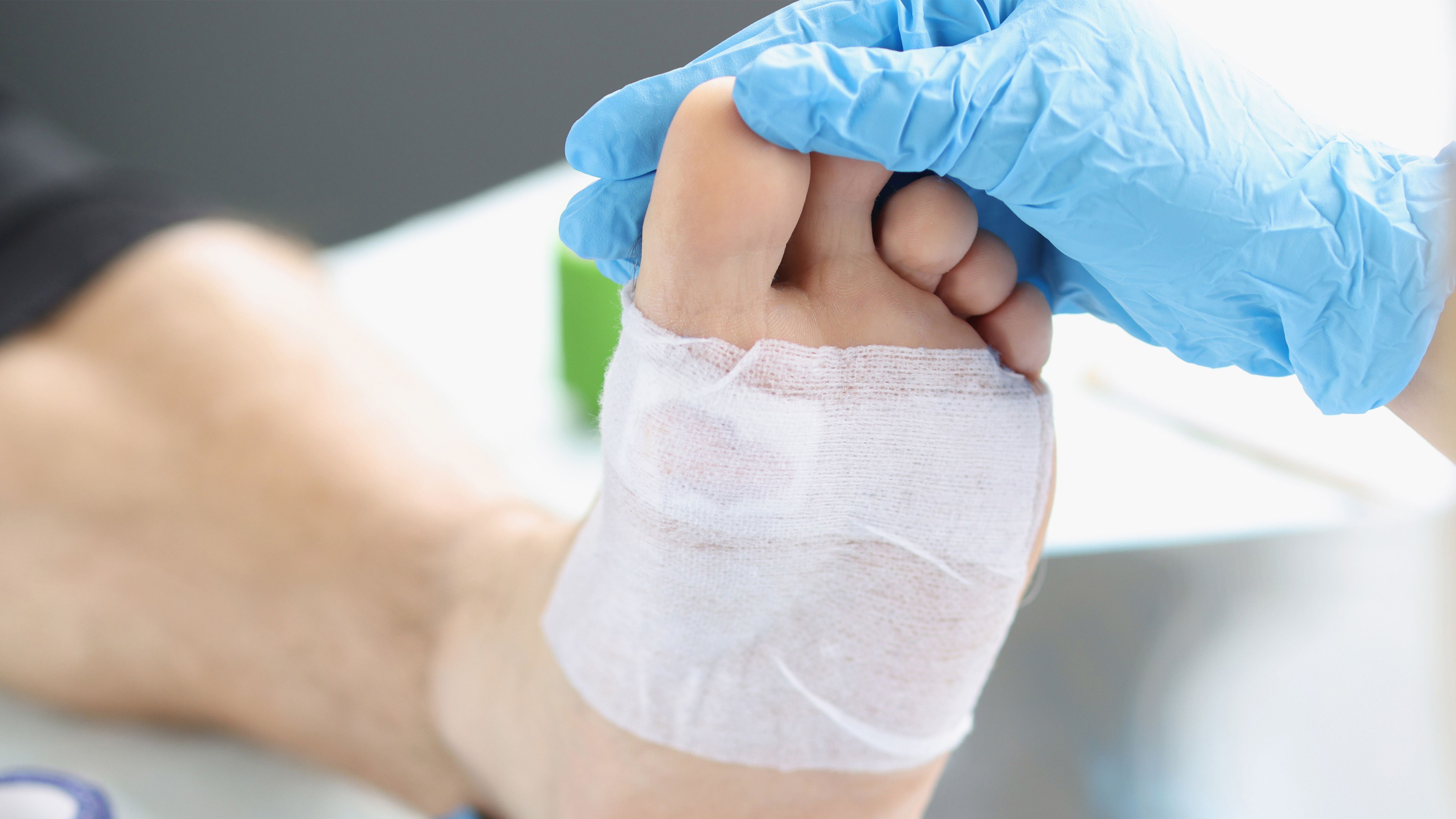 Doctor hand touches and examines wound on leg | Image credit: © megaflopp - © megaflopp - stock.adobe.com