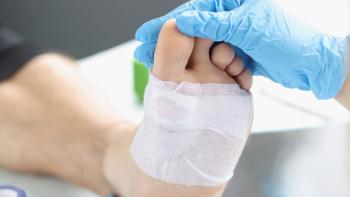 Doctor hand touches and examines wound on leg | Image credit: © megaflopp - © megaflopp - stock.adobe.com