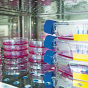 Impact of Media Components on CQAs of Monoclonal Antibodies