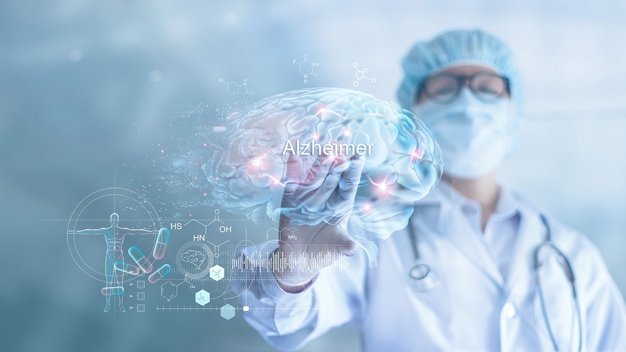 Abstract, Doctor checking and analysis alzheimer's disease and dementia of brain, testing result on virtual interface, innovative technology in science and medicine concept | Image credit: ©  ipopba - stock.adobe.com 
