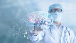 Abstract, Doctor checking and analysis alzheimer's disease and dementia of brain, testing result on virtual interface, innovative technology in science and medicine concept | Image credit: © ipopba - stock.adobe.com