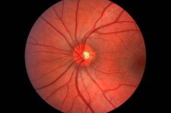Retinal imaging photograph showing the human retina and optic nerve. | Image Credit: © LightScribe - stock.adobe.com
