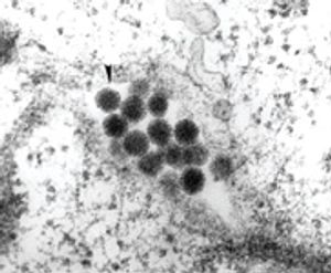 Nims-et-al-Fig.-2_t-557250-1408660351275.jpg